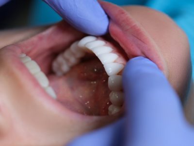 Utrzymanie zdrowia jamy ustnej