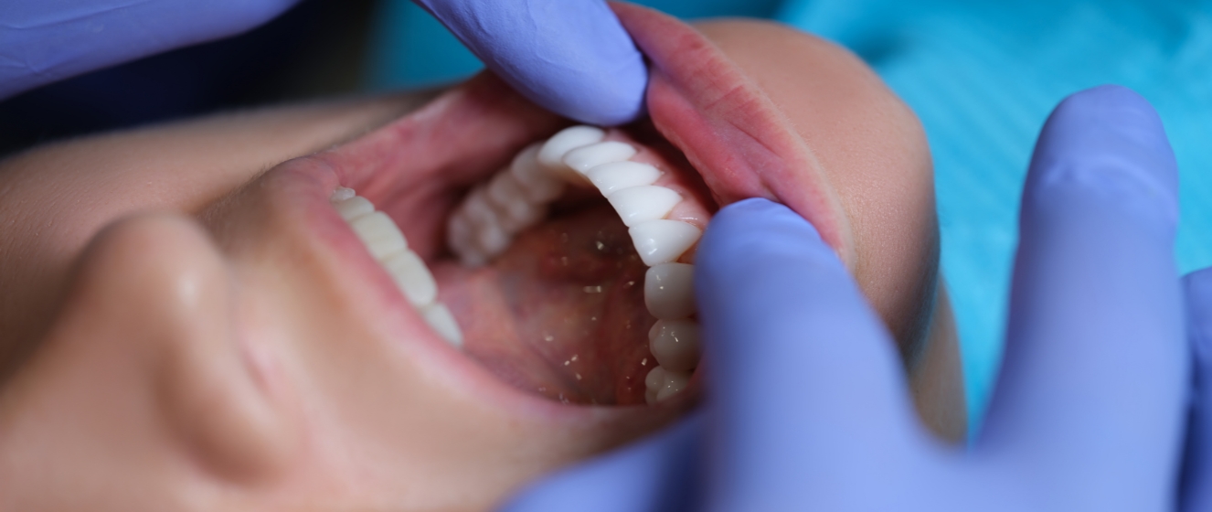 Utrzymanie zdrowia jamy ustnej